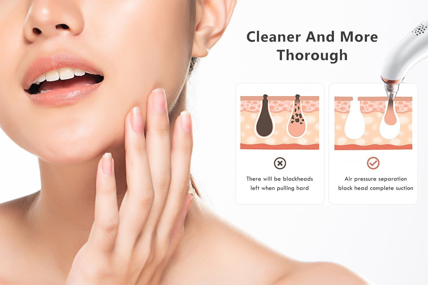 Blackheads and Impurities Remover (4 Suction Heads)