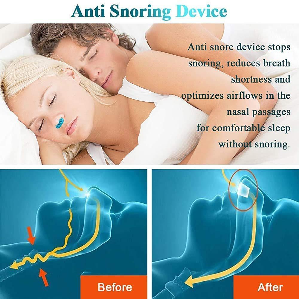 Anti-Snoring Device CPAP - Sleep Apnea Treatment