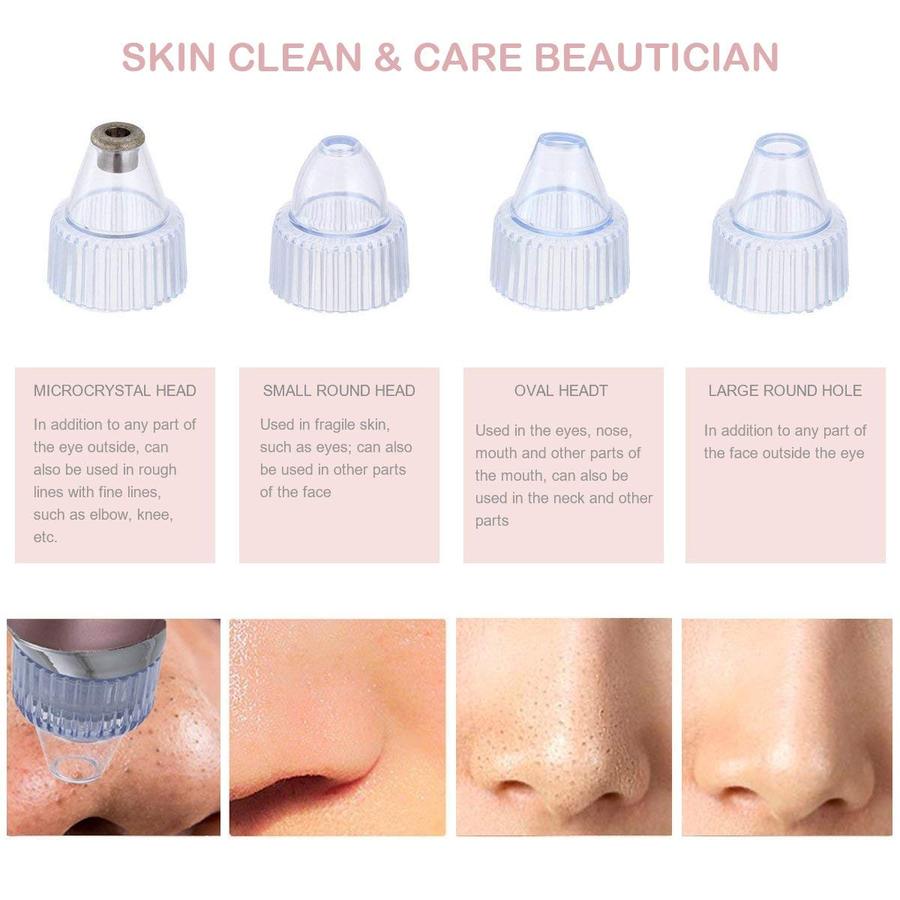 Blackheads and Impurities Remover (4 Suction Heads)